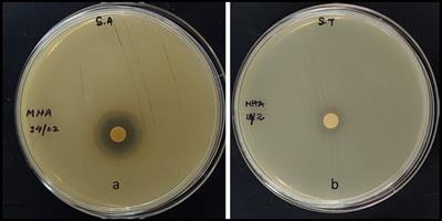 Bioactivity and nutritional quality of nutgall (Rhus semialata Murray), an underutilized fruit of Manipur